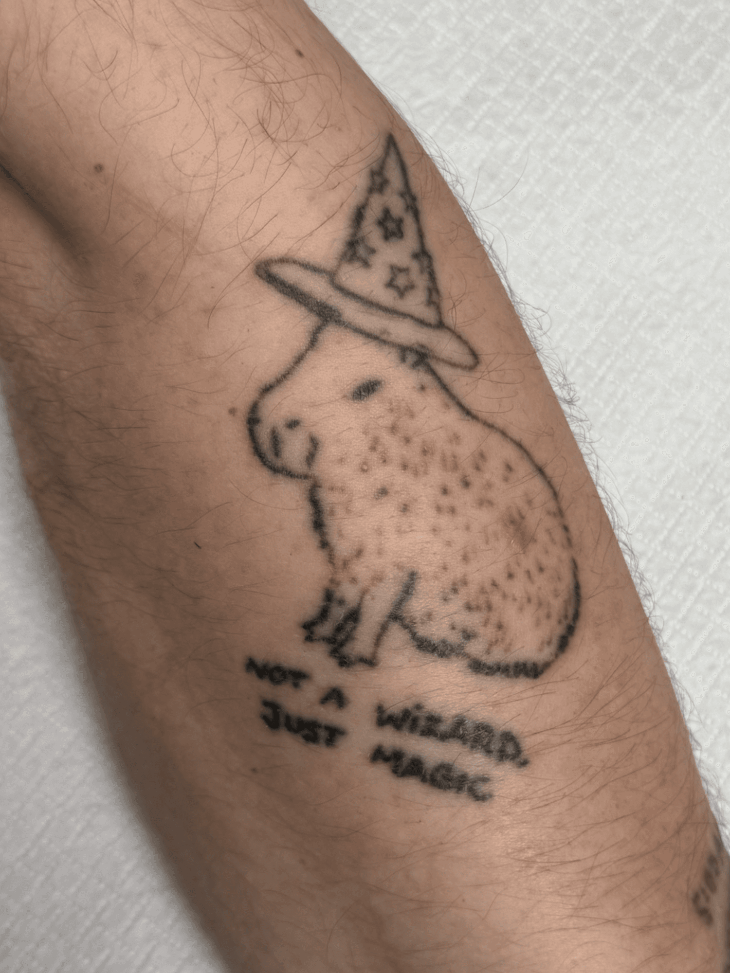 Tatuaż — przedramię, stan przed zabiegiem usuwania
