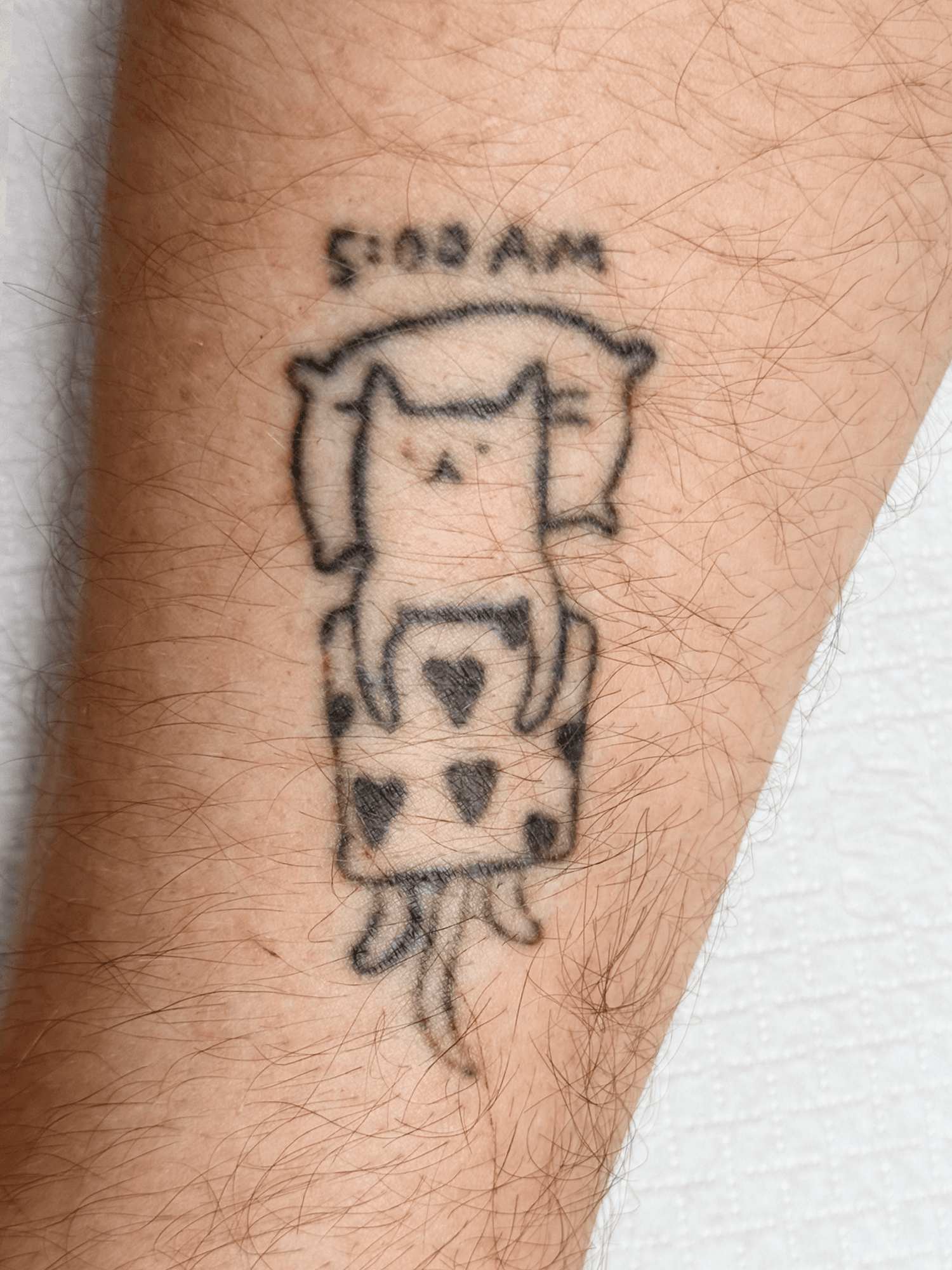 Tatuaż — przedramię, stan przed zabiegiem usuwania